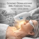 Genowe odmładzanie BBL Forever Young – twarz + szyja GRATIS - 2